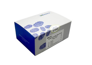 SARS-CoV-2 Antigen Rapid Test Kit