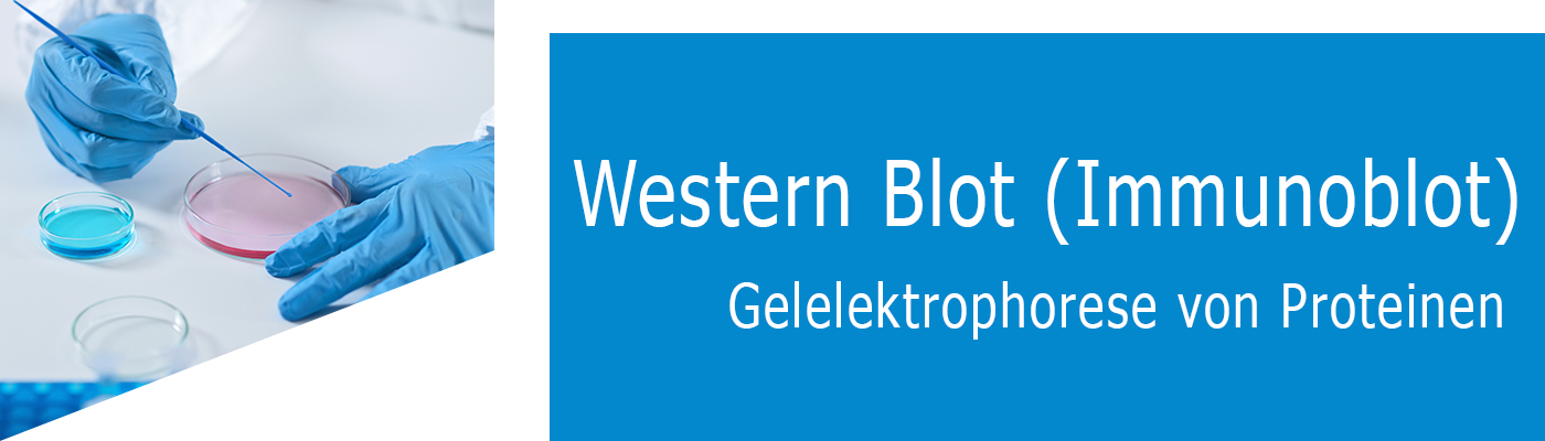 Western Blot Immunoblot Gelelektrophorese von Proteinen2