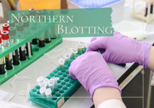 Northern Blotting