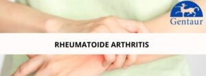 Rheumatoide arthritis warum schmerzen unsere gelenke hauptbild des artikels