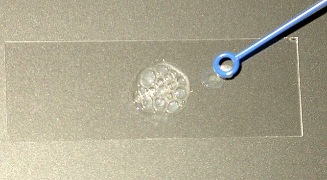 typen-von-katalasen-reaktion Typen von katalasen - reaktion